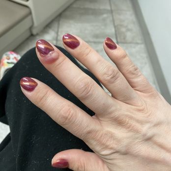 Angel Nails & Spa - Getting the infection treated - Nail Salons Near Me - Las Vegas, Nevada