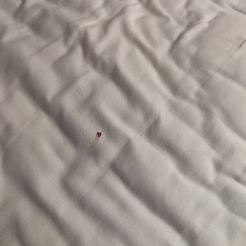 Lancaster Inn & Suites - Bedbug smear - Hotels Near Me - Manheim, Pennsylvania Lancaster Inn & Suites - Bedbug smear - Hotels Near Me - Manheim, Pennsylvania
