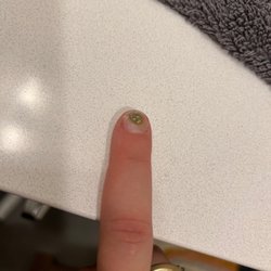 Lotus Nails - Fungus under nail