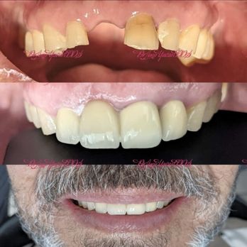 LUNA Dental - Cosmetic Dentists Near Me - El Paso, Texas LUNA Dental - Cosmetic Dentists Near Me - El Paso, Texas