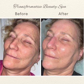 Transformative Beauty Spa - Skin Care Near Me - Folsom, California Transformative Beauty Spa - Skin Care Near Me - Folsom, California
