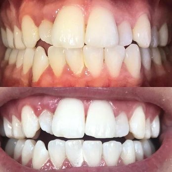 The Smile Doctor - Teeth Whitening Near Me The Smile Doctor - Teeth Whitening Near Me