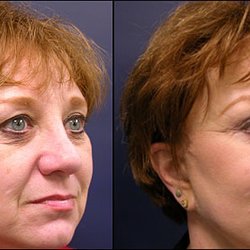 Chicago Face And Body Surgery