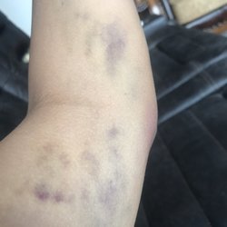 Southtown Clinic - Week two: got worse!