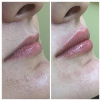 SkinSpirit - Seattle - Skin Care Near Me - Seattle, Washington SkinSpirit - Seattle - Skin Care Near Me - Seattle, Washington