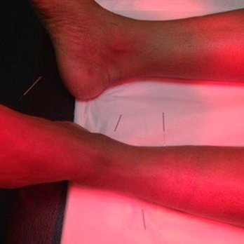 Syn's Acupuncture Clinic - Acupuncture Near Me - Fredericksburg, Virginia