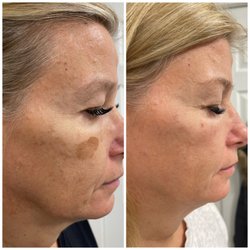 A Beauty Skin & Laser - Spectra