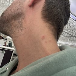 Comfort Inn Bay City - Riverfront - Bed bug bites