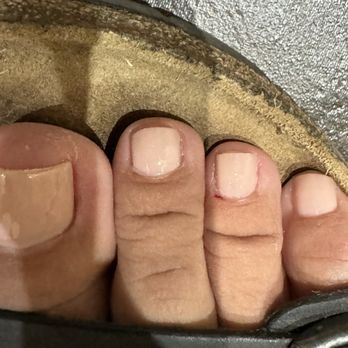 AMOR NAIL LOUNGE - See the 3rd toe. Blood from being cut by lady doing my pedicure. - Nail Salons Near Me - Downey, California