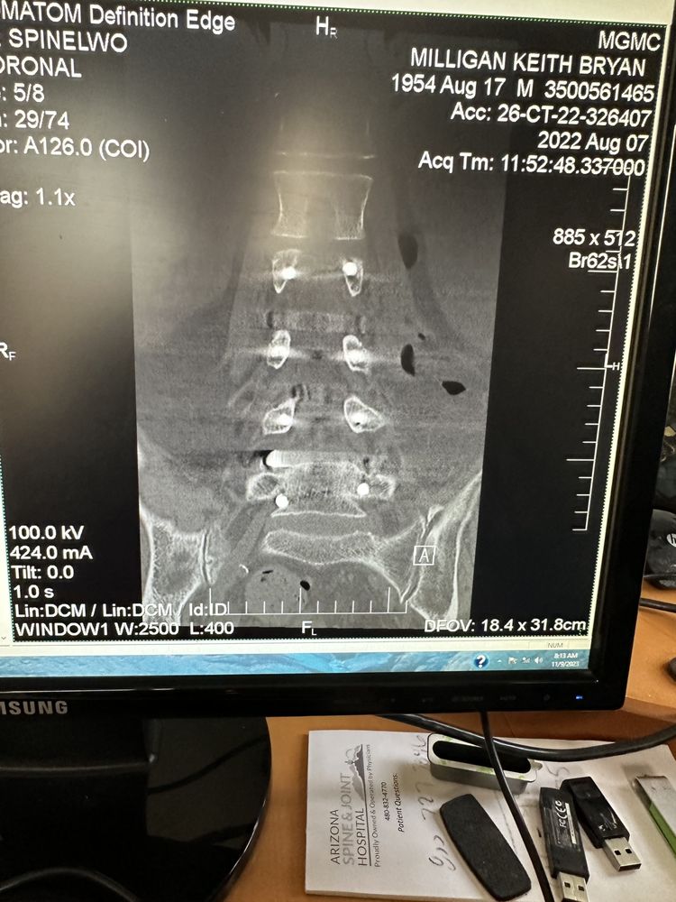 Arizona Spine & Joint Hospital - patient advocate in Mesa, AZ