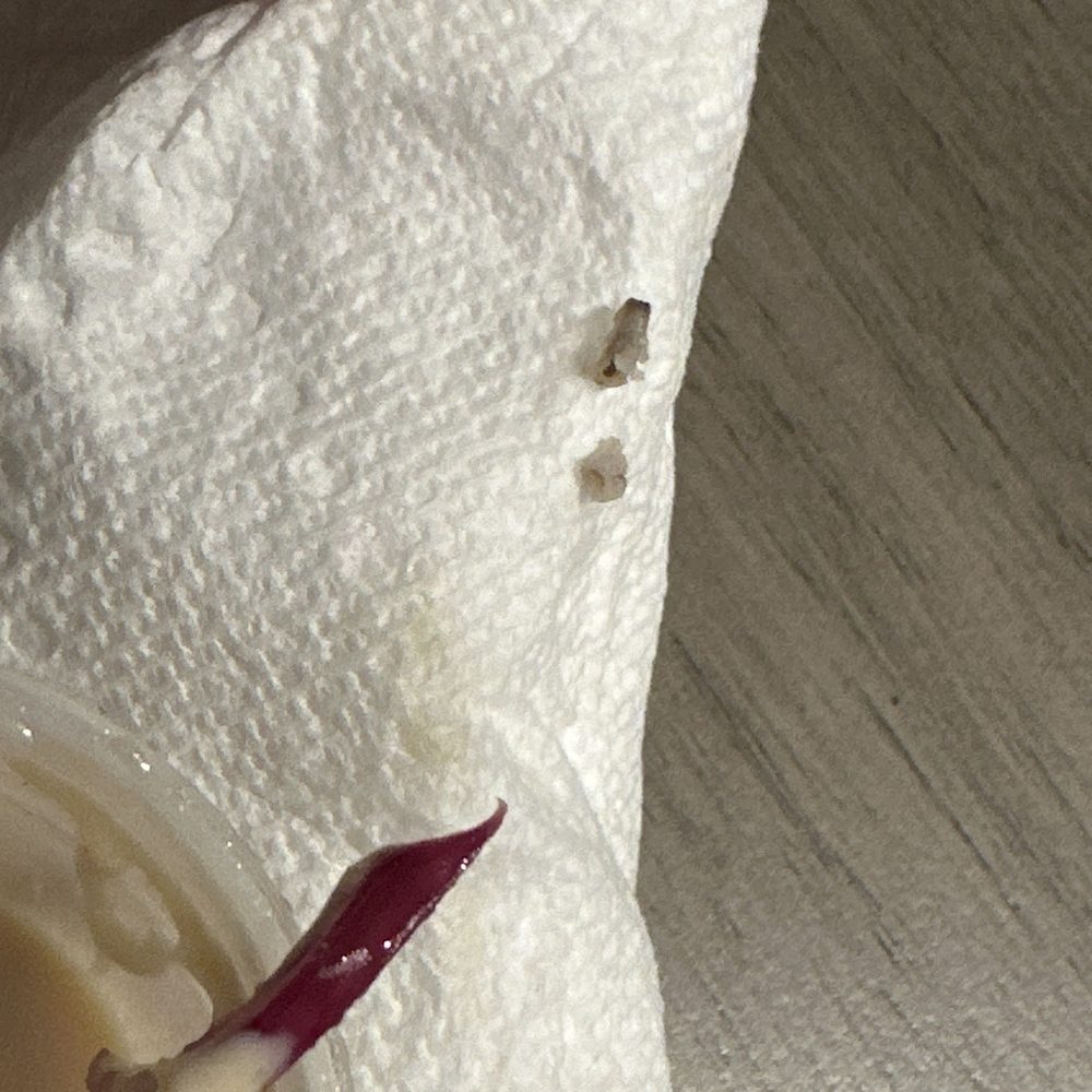 Anzo - Drove all the way to Boynton Beach from Boca just to get a bowl. So disgusting! Found a maggot in my food. Will never go back. - Mediterranean Near Me - Boynton Beach, Florida Anzo - Drove all the way to Boynton Beach from Boca just to get a bowl. So disgusting! Found a maggot in my food. Will never go back. - Mediterranean Near Me - Boynton Beach, Florida