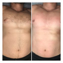 WaxNGlow - Full Chest+ Full Stomach Wax