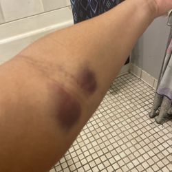 CSL Plasma - Went to the dontae this what happened to me