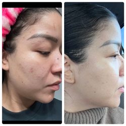 Skin By Blue
