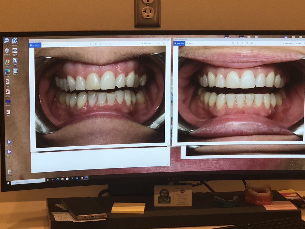 FAST DENTAL FRESNO Updated September 2024 8380 N Fresno St, Fresno