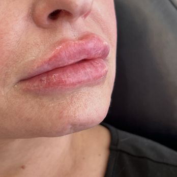 Young Again Cosmetic Injections - Aestheticians Near Me - Scottsdale, Arizona Young Again Cosmetic Injections - Aestheticians Near Me - Scottsdale, Arizona