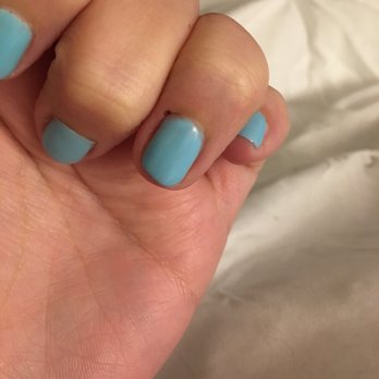 Lotus Nails & Spa - This cut may look small but it is very deep. And notice the very uneven file job... - Nail Salons Near Me - Burbank, California