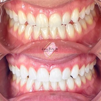 Kamie’s Beauty Bar - Teeth whitening - Eyebrow Services Near Me - Arlington, Washington Kamie’s Beauty Bar - Teeth whitening - Eyebrow Services Near Me - Arlington, Washington