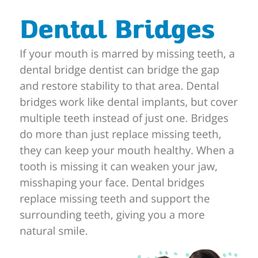 This website states it right on their site that missing teeth can misaligned your face, causing misshaping. This website states it right on their site that missing teeth can misaligned your face, causing misshaping.