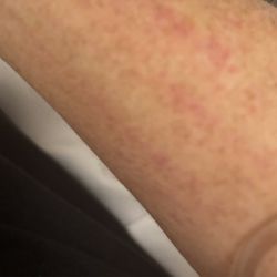 Bailey Medical Center - Rash