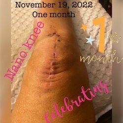 Month 1
