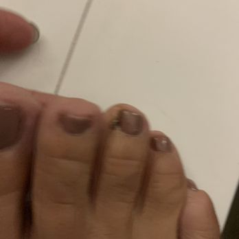 Bella Nails & Spa - Closer view of the cut to the smaller toe. - Nail Salons Near Me - Upland, California