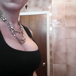 Doctors Plastic Surgery - This is in May 2015. My surgery was February 24, 2015.