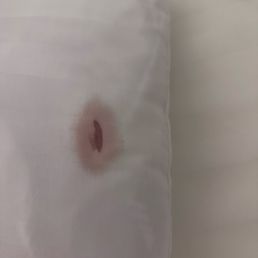 Blood stain on unclean pillow Blood stain on unclean pillow