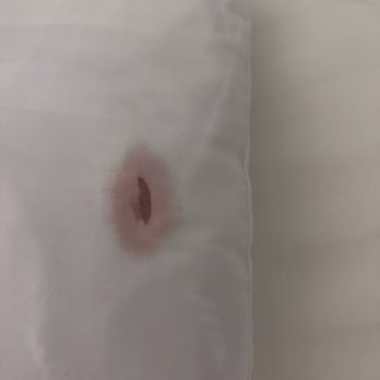 Sea Horse Resort - Blood stain on unclean pillow - Hotels Near Me - San Clemente, California Sea Horse Resort - Blood stain on unclean pillow - Hotels Near Me - San Clemente, California