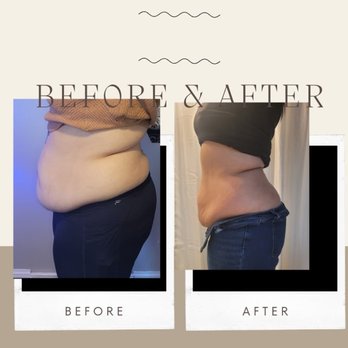 Devine Cryo Lounge - Cryotherapy Near Me Devine Cryo Lounge - Cryotherapy Near Me