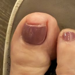 My big toe is crying My big toe is crying