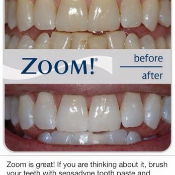 Kenneth E Stoner, DDS - Zoom! - General Dentistry Near Me - Ashland, Virginia