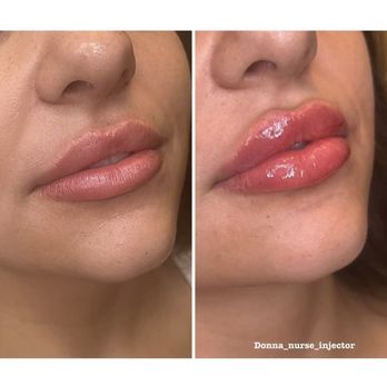 SkinDelish - Aestheticians Near Me - Glendale, Arizona
