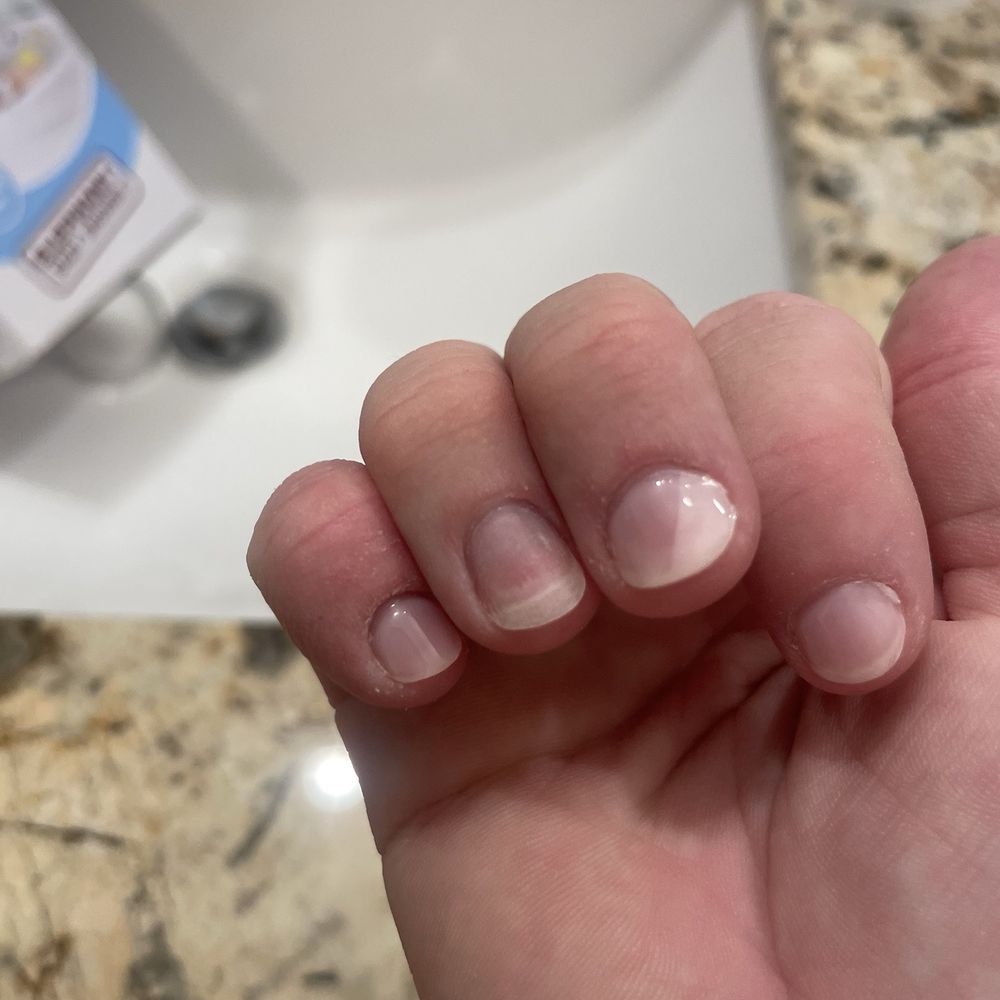 Aura Nail & Spa - Gel polish lifting after just 6 hours & a shower. - Nail Salons Near Me - Houston, Texas
