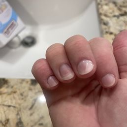 Gel polish lifting after just 6 hours & a shower. Gel polish lifting after just 6 hours & a shower.