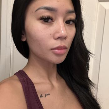Glow DermSolutions - 5 days post facial treatment-- trusting the process... - Cosmetics & Beauty Supply Near Me - Las Vegas, Nevada
