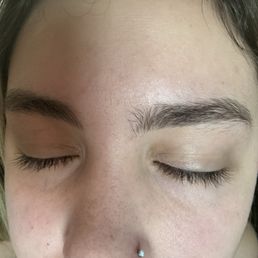 You can see how the lash tech I know was able to save my lashes and the inflammation is going down