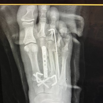 Ibrahim Akkari, DPM - Podiatrists Near Me - Long Beach, California