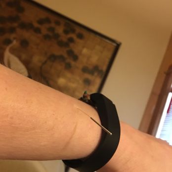 Love Acupuncture & Wellness Group - Can't even feel it. - Acupuncture Near Me - Clackamas, Oregon