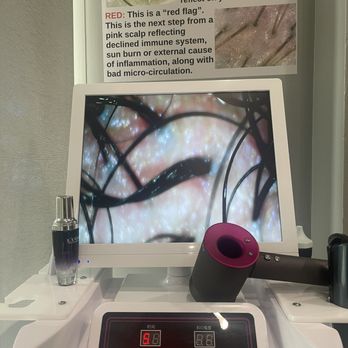Serenity Head Spa - after - Massage Near Me - Potomac, Maryland