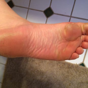 Nails To Perfection - My feet before - Nail Salons Near Me - Manchester, New Hampshire Nails To Perfection - My feet before - Nail Salons Near Me - Manchester, New Hampshire