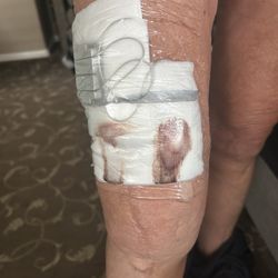 Christopher Hajnik, MD - Right knee