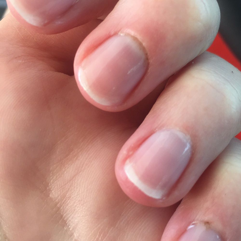 Nail Tech - Got a manicure and ended up with 4 bloody cuticles that are now inflamed and very painful. - Nail Salons Near Me - Henderson, Nevada Nail Tech - Got a manicure and ended up with 4 bloody cuticles that are now inflamed and very painful. - Nail Salons Near Me - Henderson, Nevada