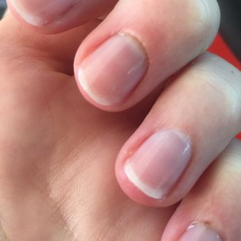 Nail Tech - Got a manicure and ended up with 4 bloody cuticles that are now inflamed and very painful. - Nail Salons Near Me - Henderson, Nevada Nail Tech - Got a manicure and ended up with 4 bloody cuticles that are now inflamed and very painful. - Nail Salons Near Me - Henderson, Nevada