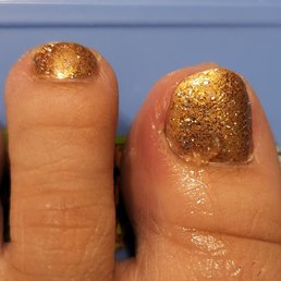 Red, swollen, painful left toe after pedicure.