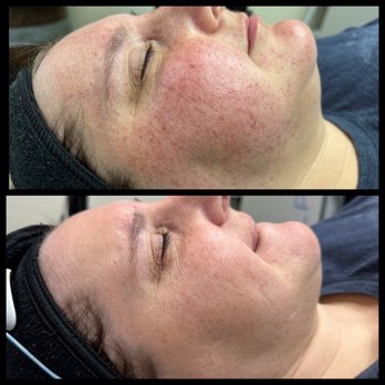 vIVid Life Spa - Medical Spas Near Me - Norwalk, Iowa vIVid Life Spa - Medical Spas Near Me - Norwalk, Iowa
