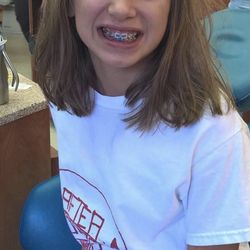 Lund Orthodontics - Kirkland - Kiera got braces