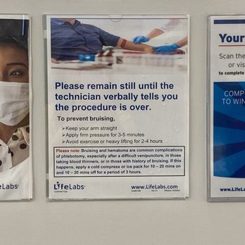 LifeLabs - Bruises may happen with the drawing of blood. - Medical Centers Near Me - Burnaby, British Columbia