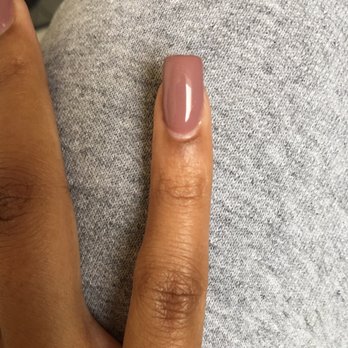 Nail Tek - Update: skin is finally starting to heal a week later - Nail Salons Near Me - Grand Blanc, Michigan Nail Tek - Update: skin is finally starting to heal a week later - Nail Salons Near Me - Grand Blanc, Michigan
