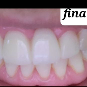 OraBell Dental Implant Centers - Cosmetic Dentists Near Me - Van Nuys, California OraBell Dental Implant Centers - Cosmetic Dentists Near Me - Van Nuys, California